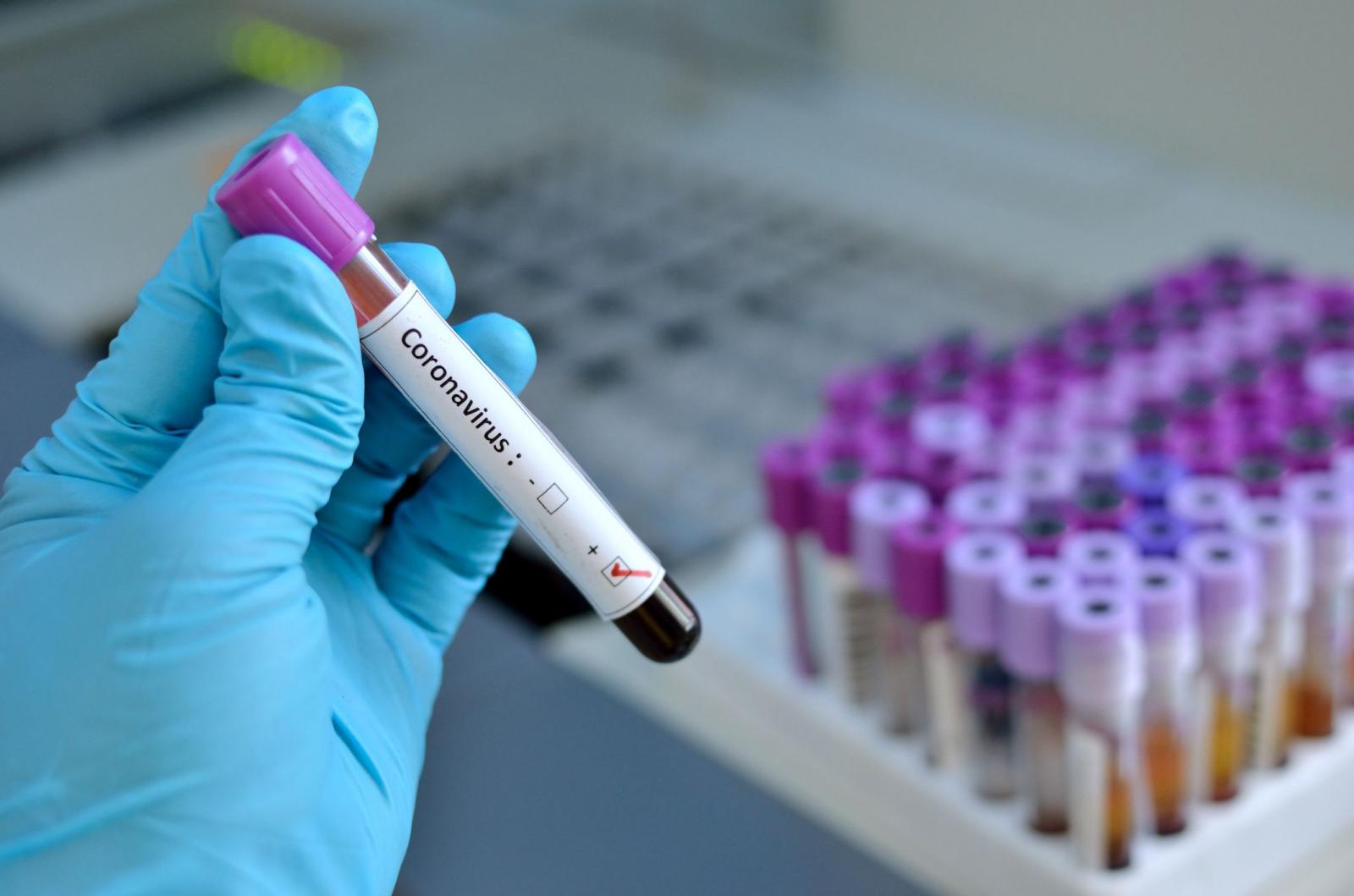 Coronavirus : 147 pèlerins testés positifs sur un effectif de 590